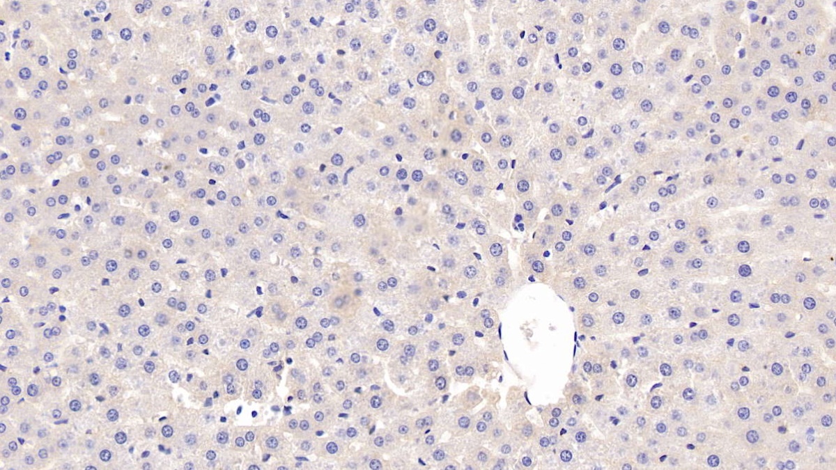 Monoclonal Antibody to C Reactive Protein (CRP)