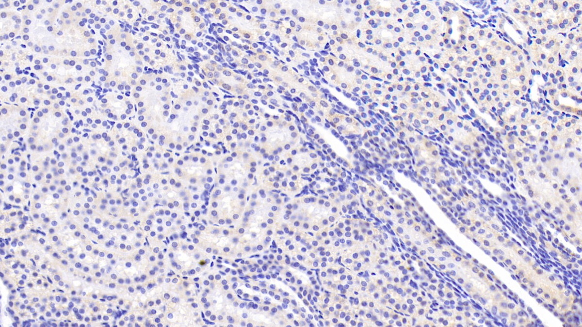 Monoclonal Antibody to Heat Shock Protein 60 (Hsp60)