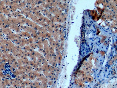 Monoclonal Antibody to Nitric Oxide Synthase 2, Inducible (NOS2)