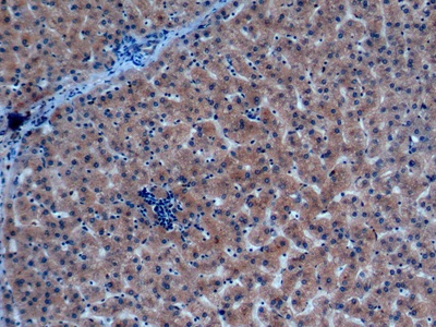 Monoclonal Antibody to Nitric Oxide Synthase 2, Inducible (NOS2)