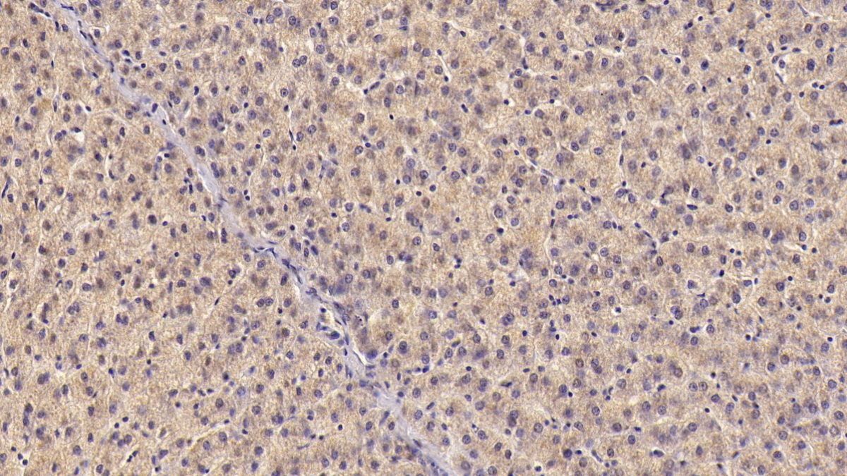 Monoclonal Antibody to Nitric Oxide Synthase 2, Inducible (NOS2)