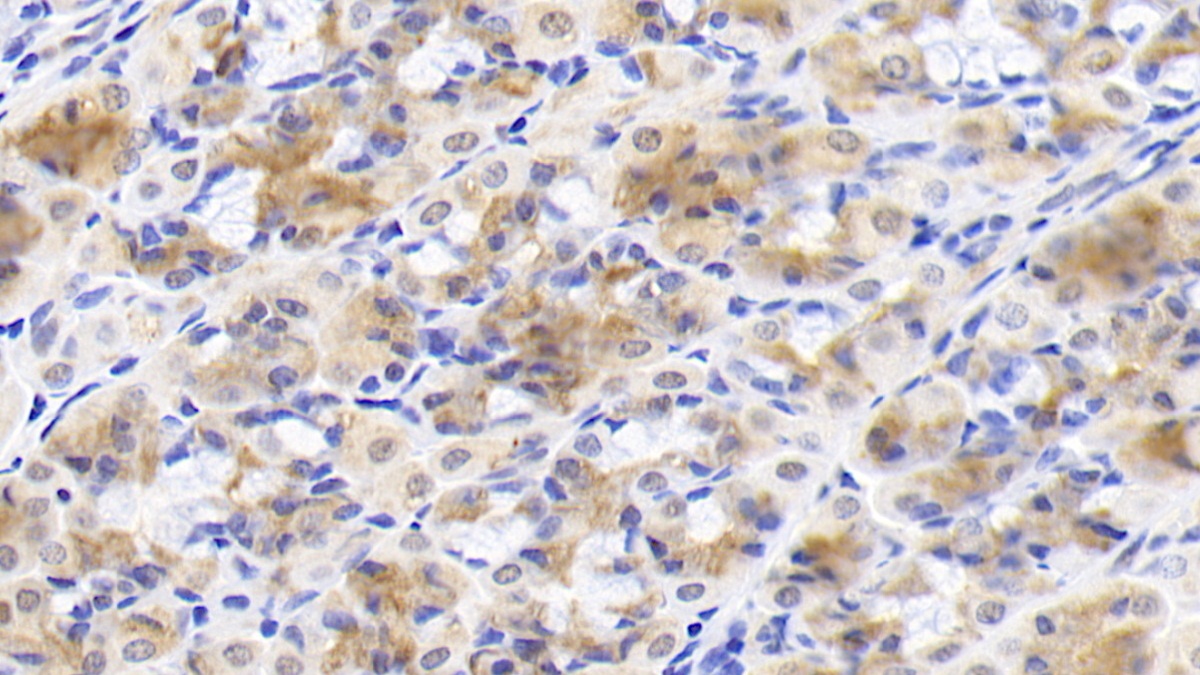 Monoclonal Antibody to Inhibin Beta A (INHbA)