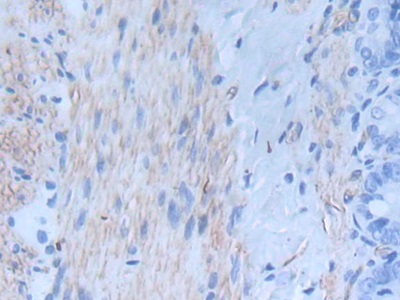 Monoclonal Antibody to Inhibin Beta A (INHbA)