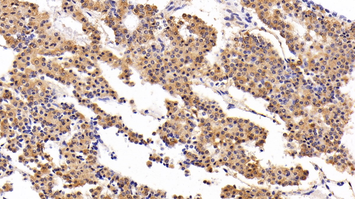 Monoclonal Antibody to Prolactin (PRL)