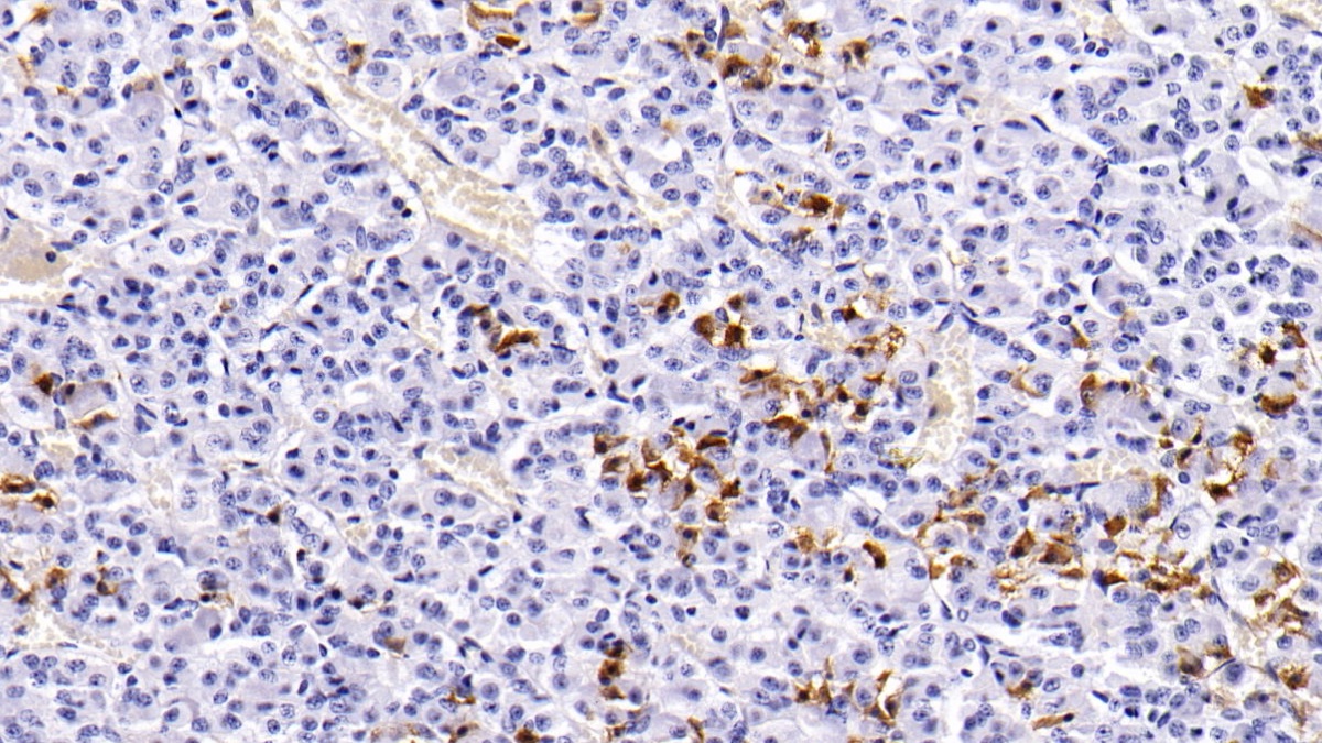 Monoclonal Antibody to Prolactin (PRL)