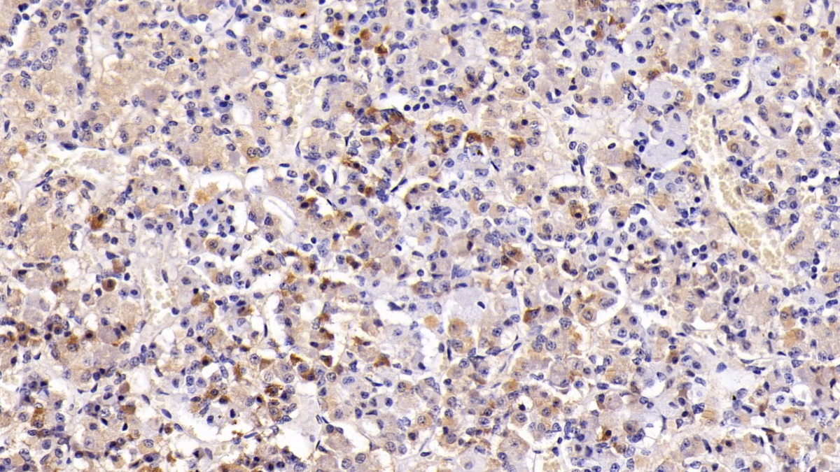 Monoclonal Antibody to Prolactin (PRL)