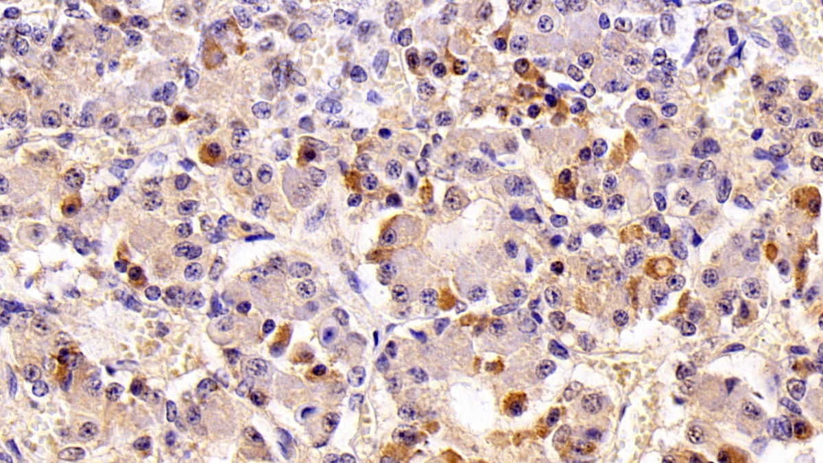 Monoclonal Antibody to Prolactin (PRL)