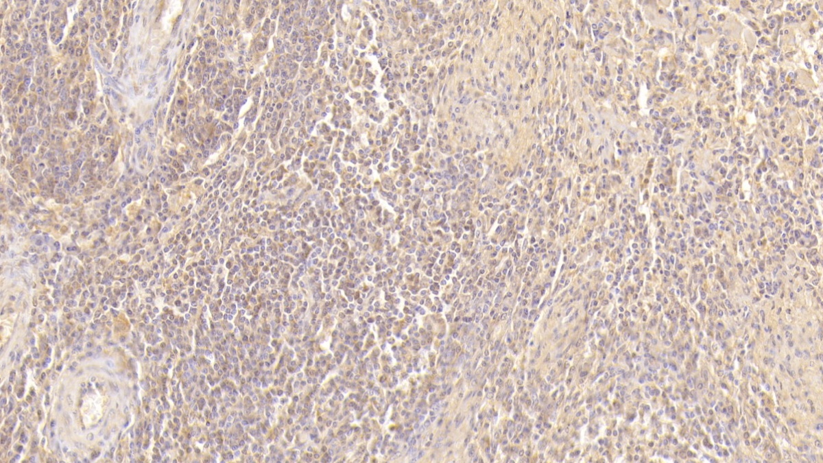 Monoclonal Antibody to Resistin (RETN)