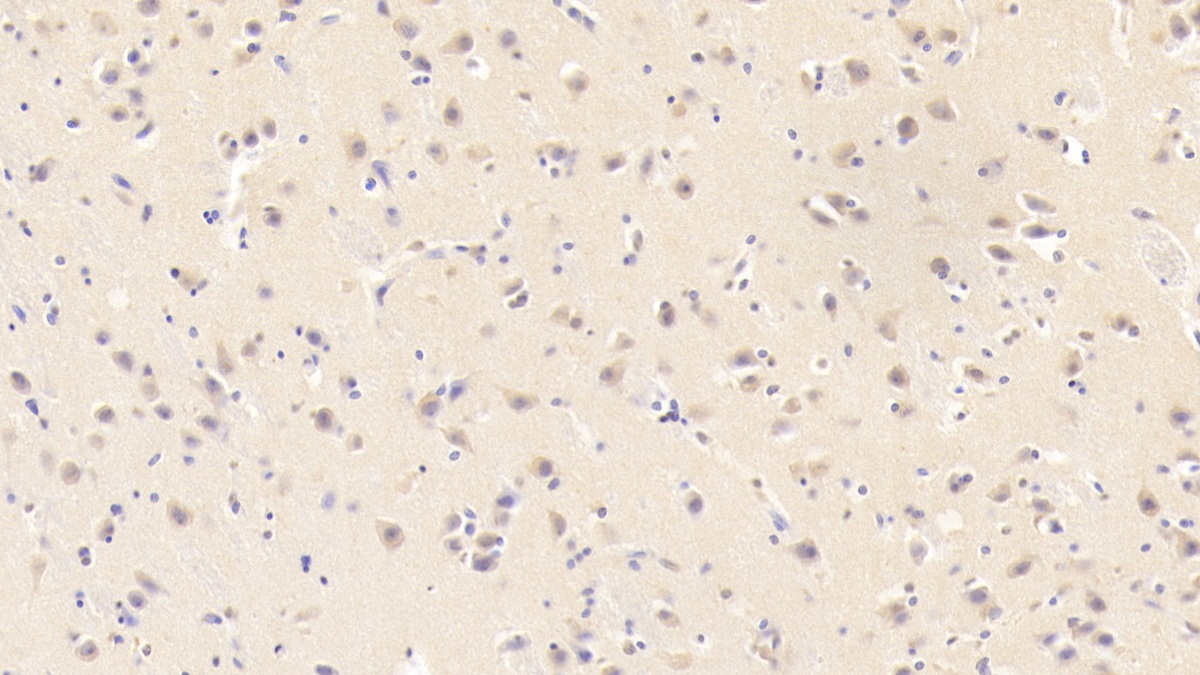 Monoclonal Antibody to Resistin (RETN)