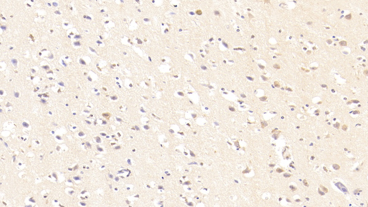 Monoclonal Antibody to Resistin (RETN)