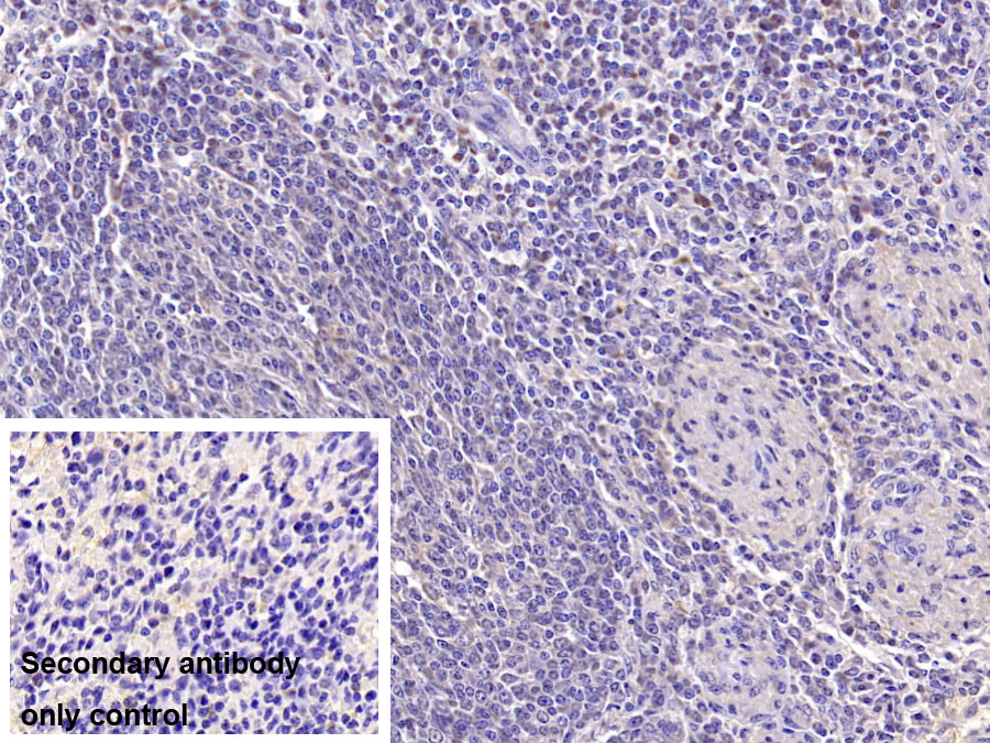 Monoclonal Antibody to Resistin (RETN)