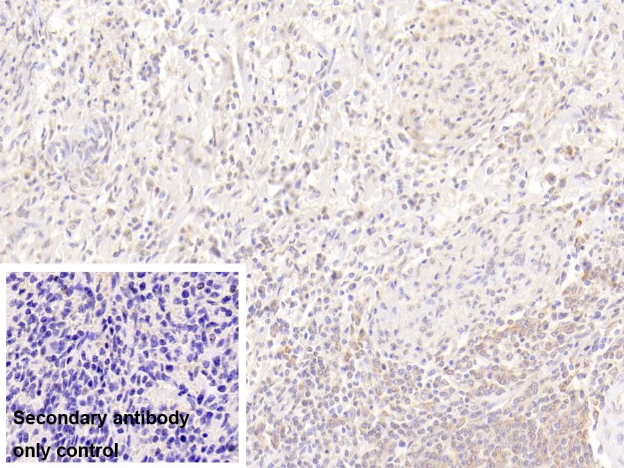 Monoclonal Antibody to Resistin (RETN)