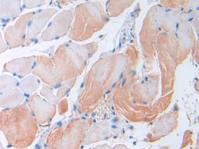 Monoclonal Antibody to Resistin (RETN)