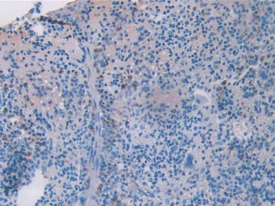 Monoclonal Antibody to Resistin (RETN)