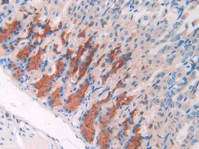 Monoclonal Antibody to Resistin (RETN)