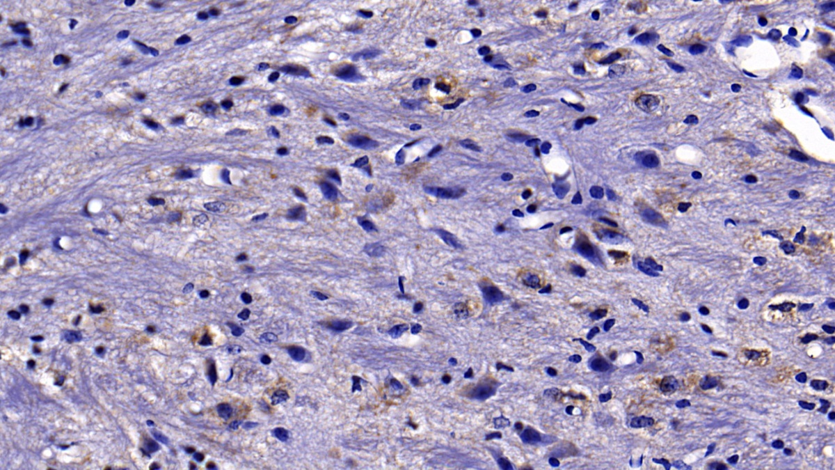 Monoclonal Antibody to Resistin (RETN)