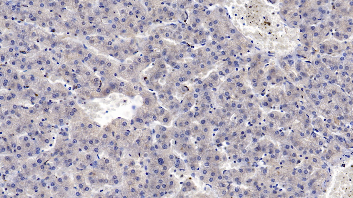 Monoclonal Antibody to Mannose Associated Serine Protease 2 (MASP2)