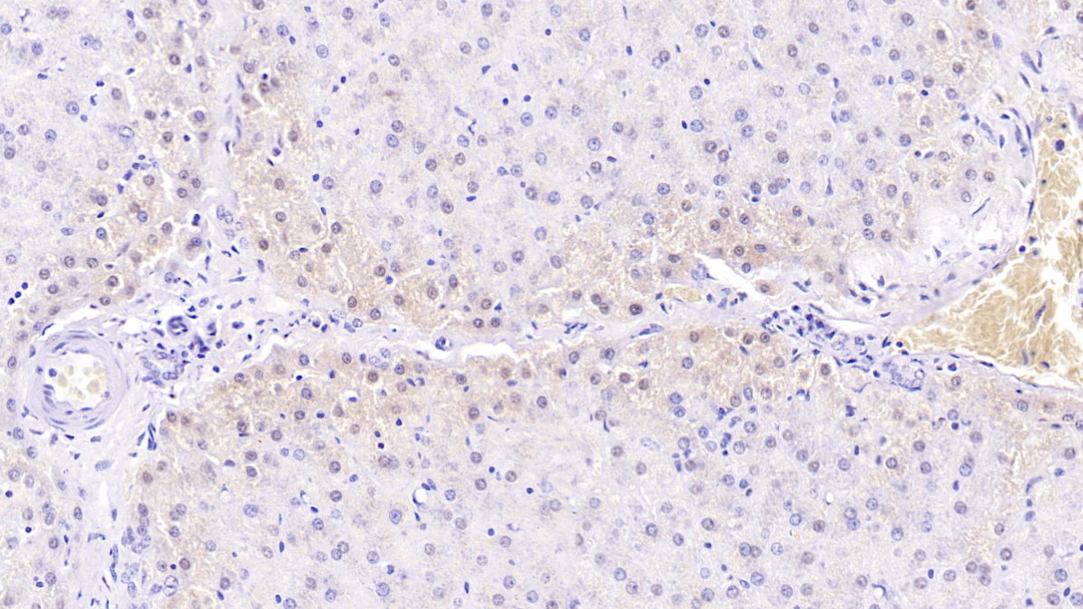 Monoclonal Antibody to Mannose Associated Serine Protease 2 (MASP2)