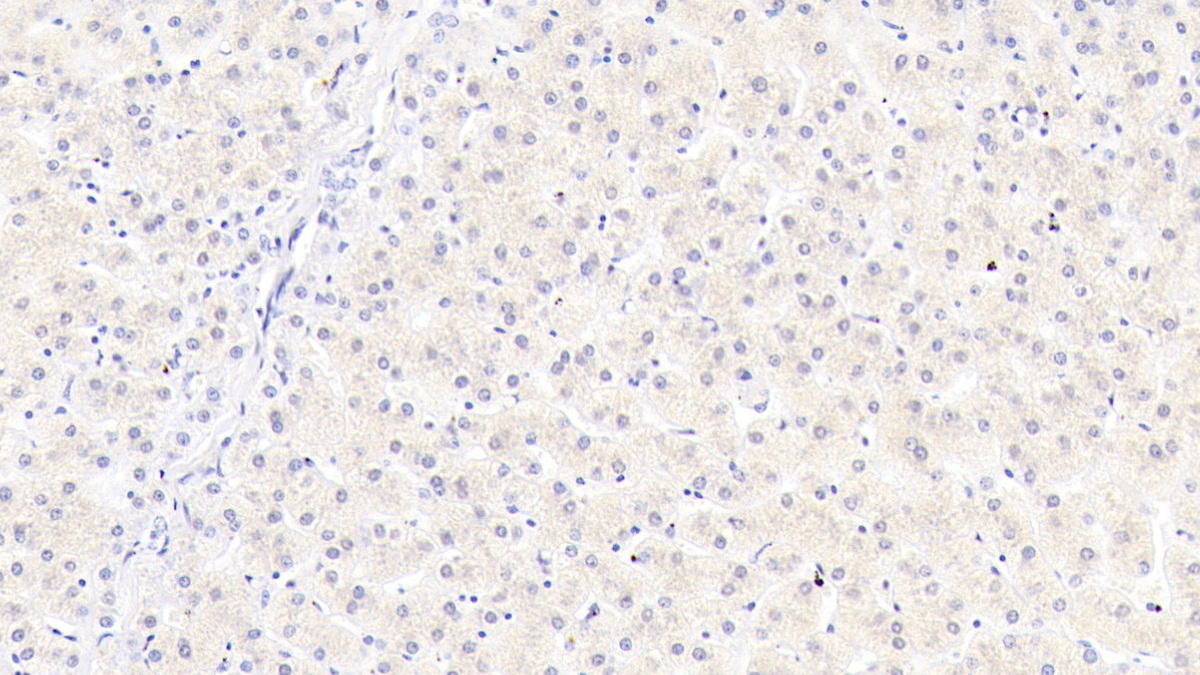 Monoclonal Antibody to Mannose Associated Serine Protease 2 (MASP2)