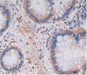 Monoclonal Antibody to Gastric Inhibitory Polypeptide (GIP)