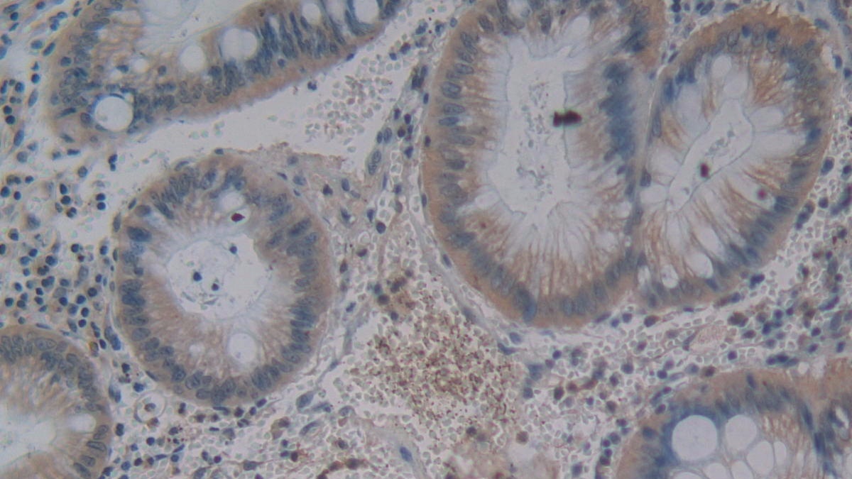 Monoclonal Antibody to Gastric Inhibitory Polypeptide (GIP)