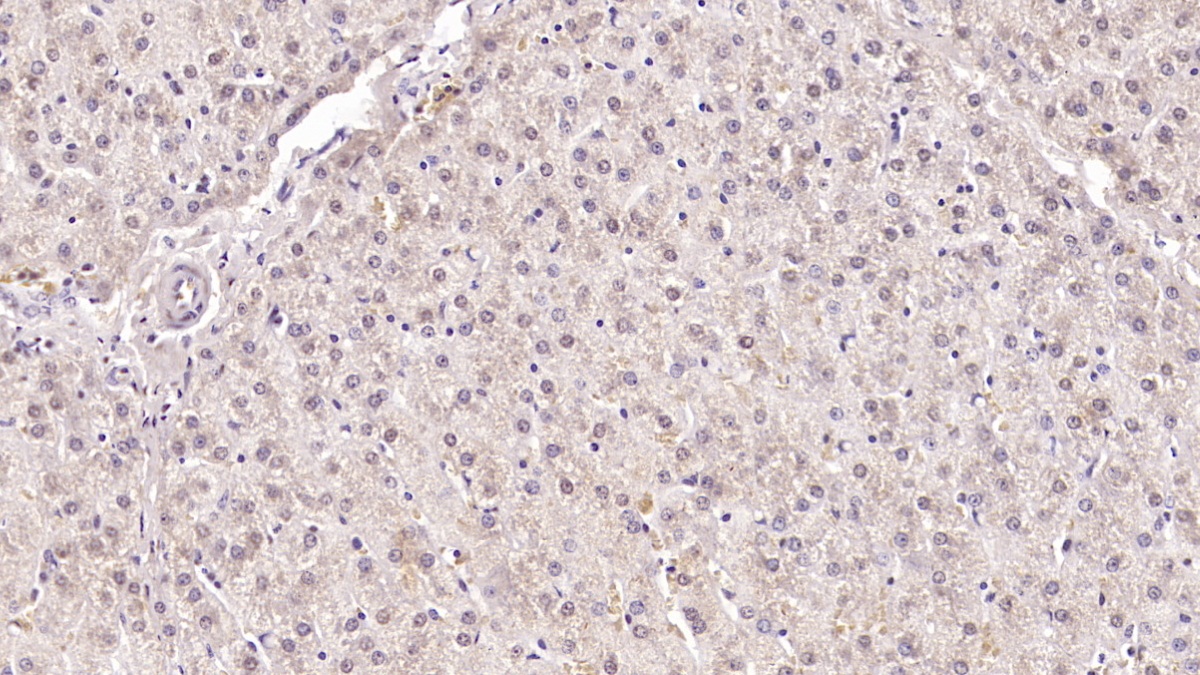 Monoclonal Antibody to Serum Amyloid A (SAA)