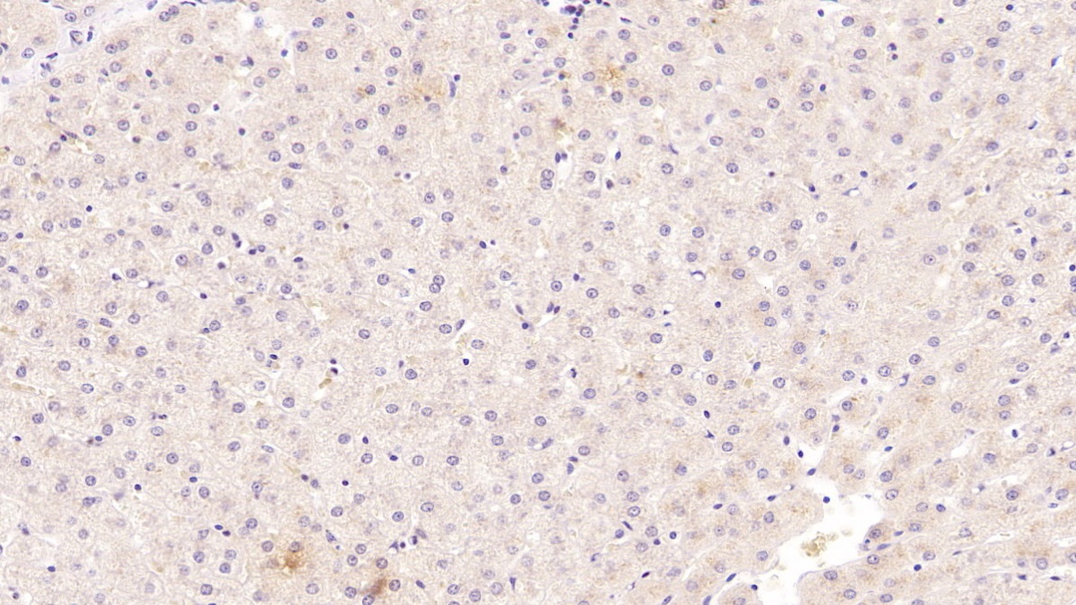 Monoclonal Antibody to Serum Amyloid A (SAA)