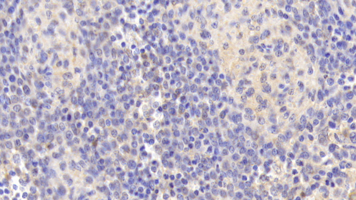 Monoclonal Antibody to Arachidonate-15-Lipoxygenase (ALOX15)