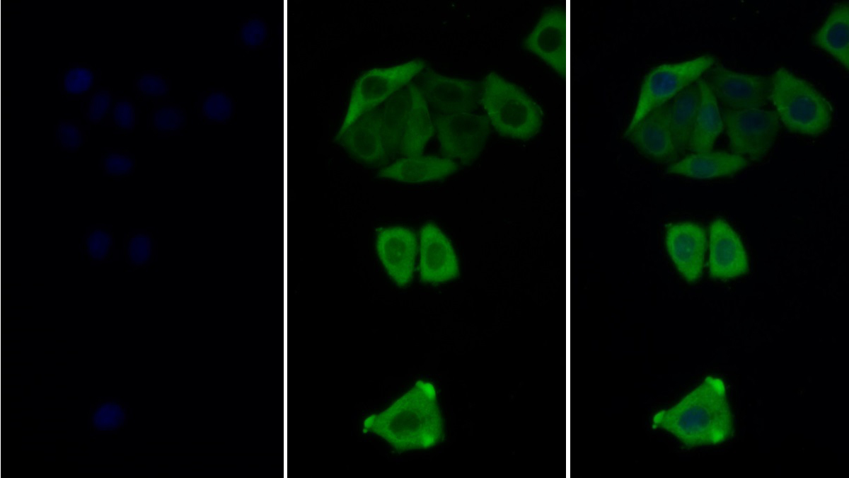 Monoclonal Antibody to Insulin Receptor (INSR)