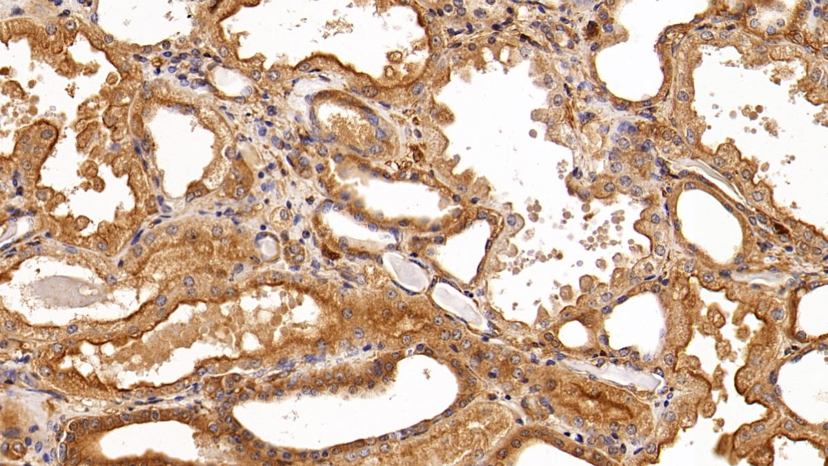 Monoclonal Antibody to Insulin Receptor (INSR)