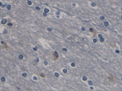 Monoclonal Antibody to Cystatin C (Cys-C)