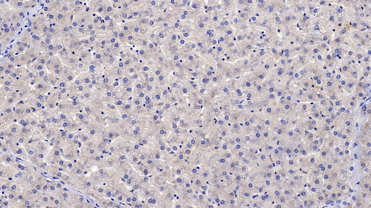 Monoclonal Antibody to Ceruloplasmin (CP)