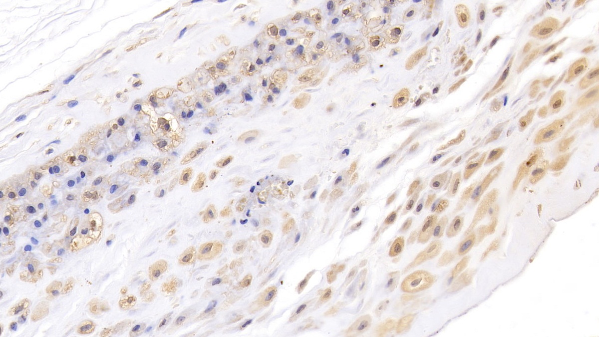 Monoclonal Antibody to Ceruloplasmin (CP)