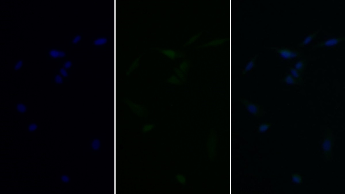 Monoclonal Antibody to Tumor Protein p53 (P53)