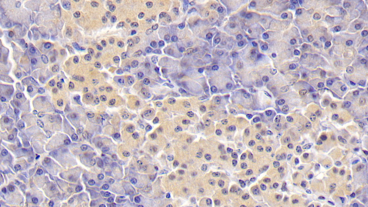 Monoclonal Antibody to Retinol Binding Protein 4 (RBP4)