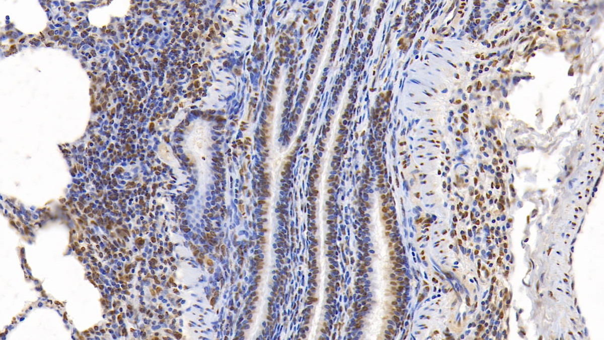 Monoclonal Antibody to Extracellular Signal Regulated Kinase 2 (ERK2)