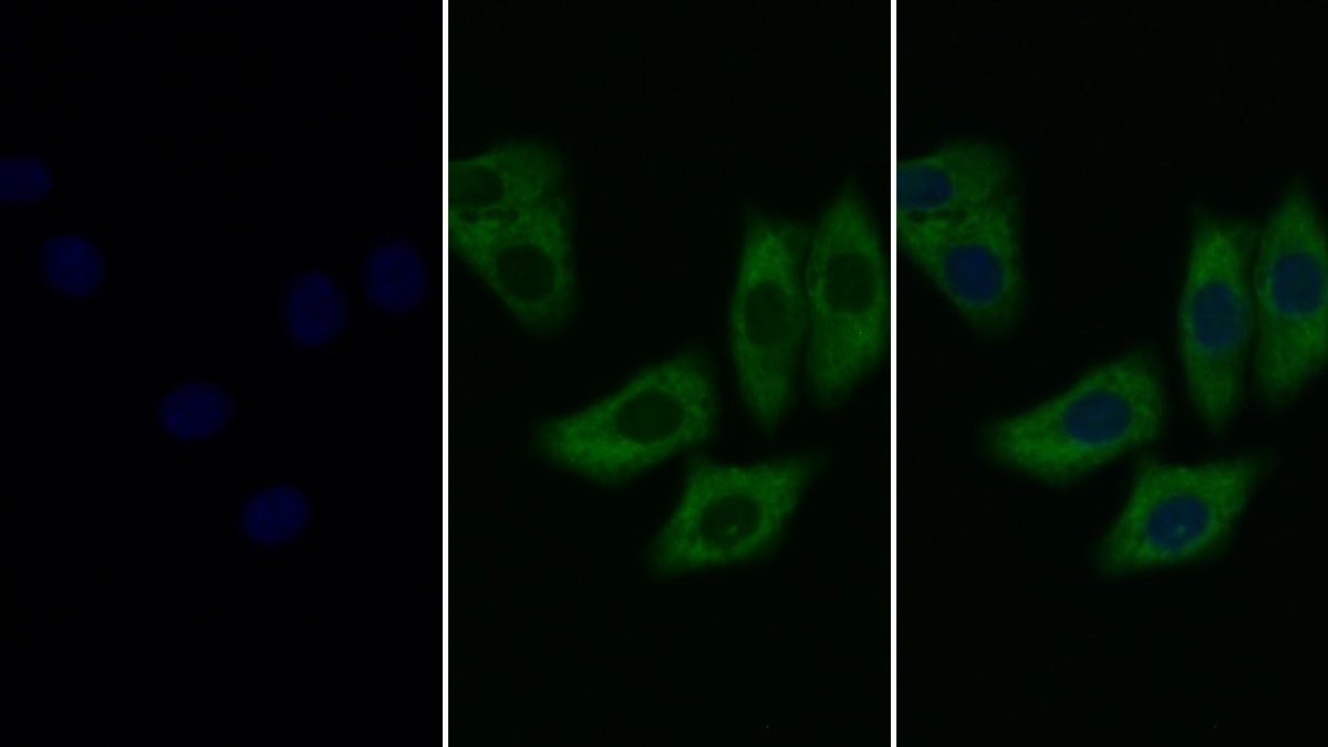 Monoclonal Antibody to Extracellular Signal Regulated Kinase 2 (ERK2)