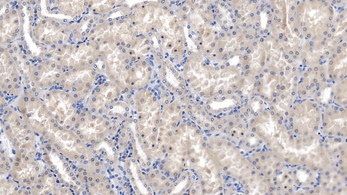 Monoclonal Antibody to Nephrin (NPHN)