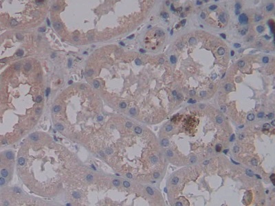 Monoclonal Antibody to Nephrin (NPHN)