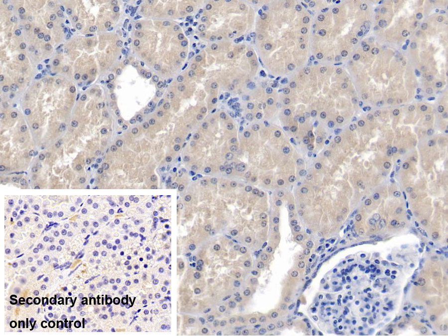 Monoclonal Antibody to Nephrin (NPHN)