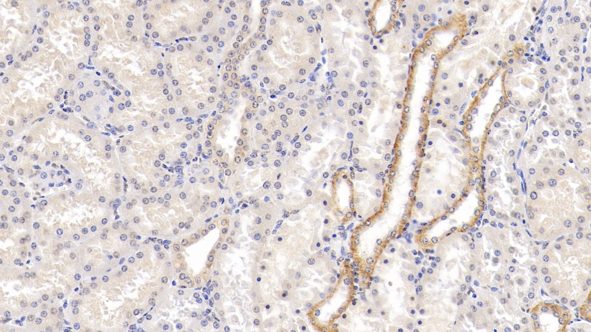 Monoclonal Antibody to Chemerin (CHEM)