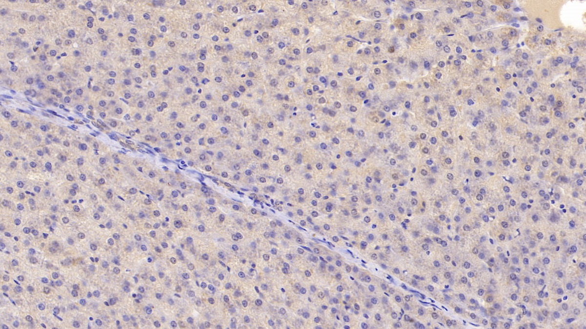 Monoclonal Antibody to Chemerin (CHEM)