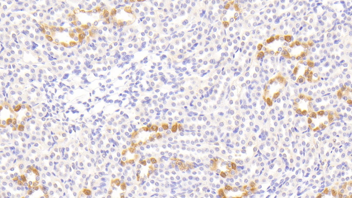 Monoclonal Antibody to Chemerin (CHEM)