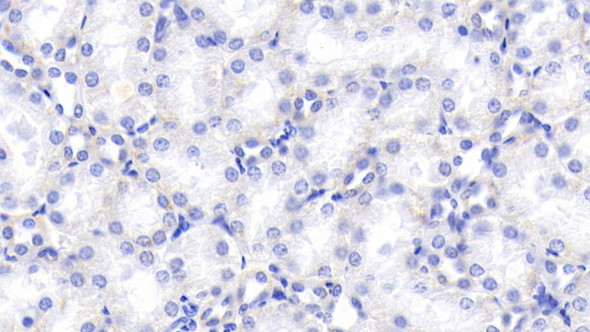 Monoclonal Antibody to Chemerin (CHEM)