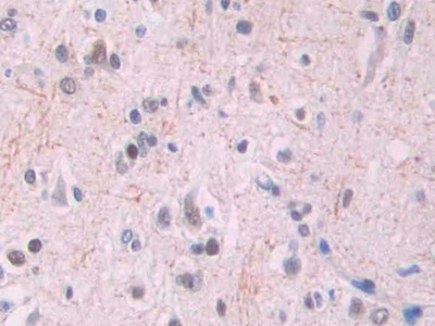 Monoclonal Antibody to Amyloid Beta Peptide 1-42 (Ab1-42)