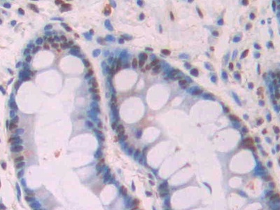 Monoclonal Antibody to Amyloid Beta Peptide 1-42 (Ab1-42)