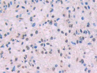 Monoclonal Antibody to Amyloid Beta Peptide 1-42 (Ab1-42)