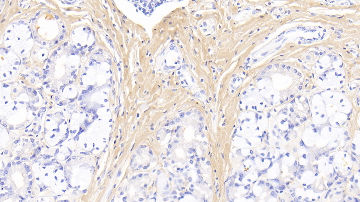 Monoclonal Antibody to Procollagen I N-Terminal Propeptide (PINP)