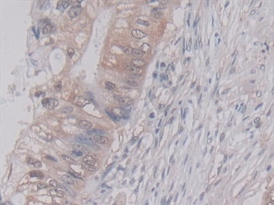 Monoclonal Antibody to Cyclophilin A (CYPA)