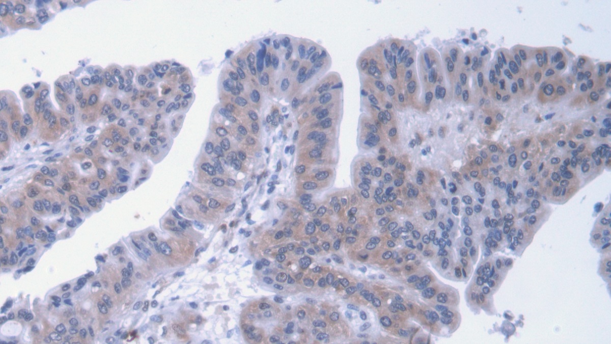 Monoclonal Antibody to Alpha-2-Macroglobulin (a2M)